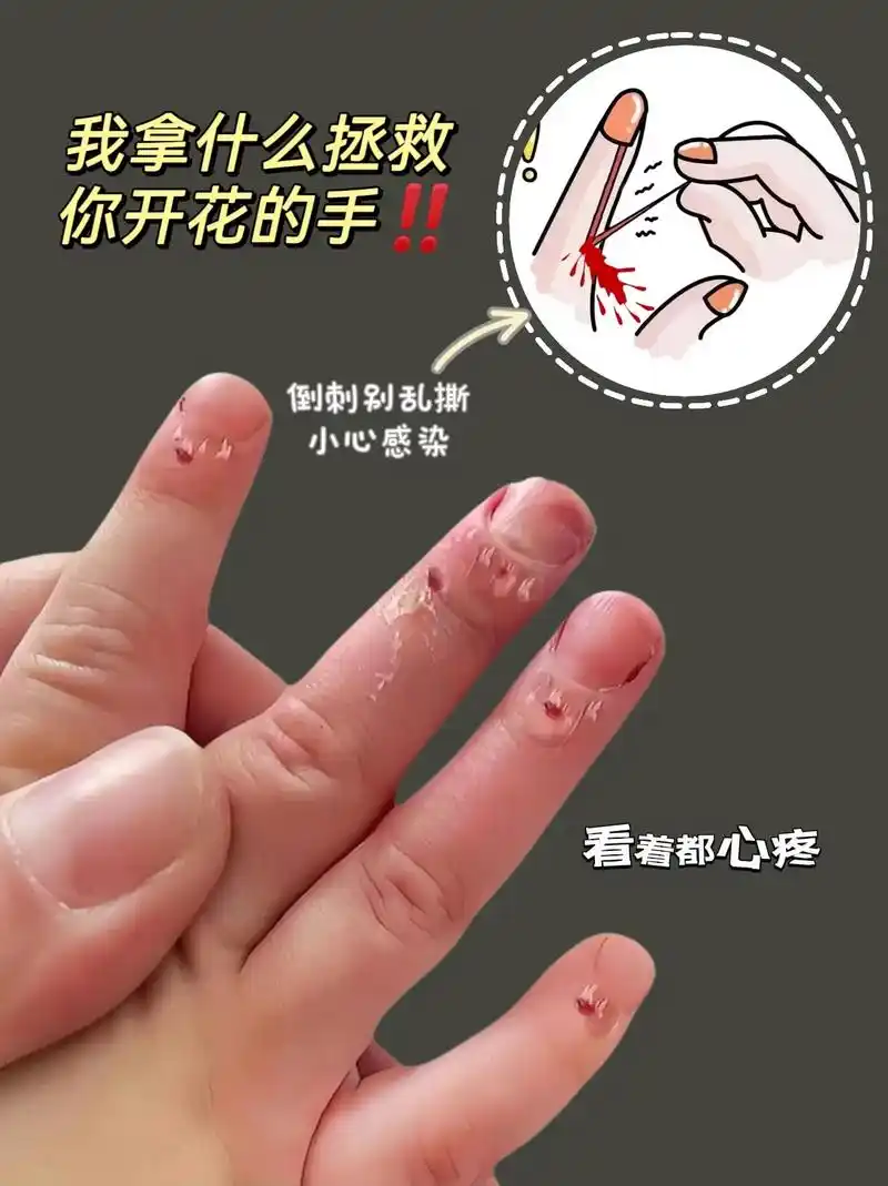 孩子长倒刺真的太疼太难受了 - 抖音