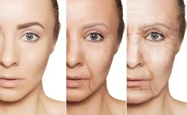 面部衰老是一种自然趋势,深平面除皱术,可以使人恢复年轻的容貌