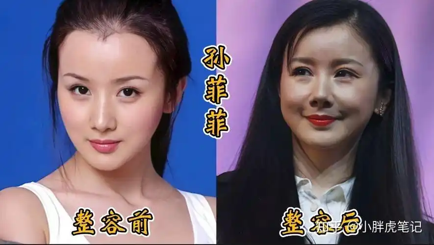 18位女明星整容前后对比邵音音面目全非杨颖堪称整容模板