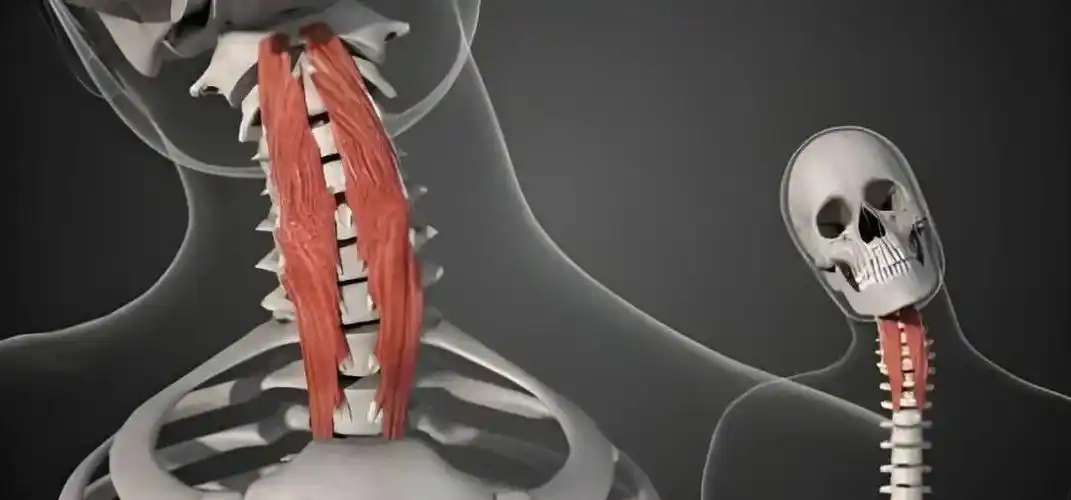 颈长肌颈部健康重中之重还要重