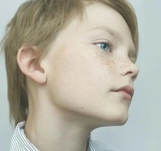 孩子雀斑小孩一般长的是什么斑?小孩最常见长的是雀斑点!