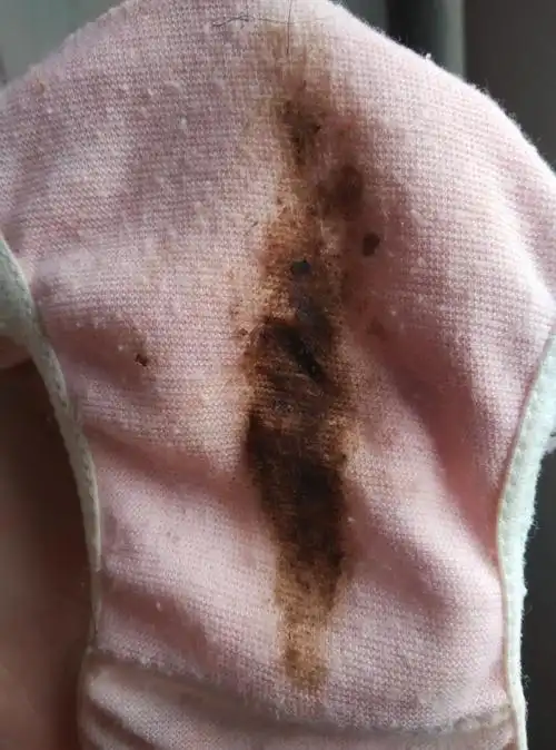 怎么月经是这个颜色的啊,而且半个多月还没完,这到底是月经不调还是药