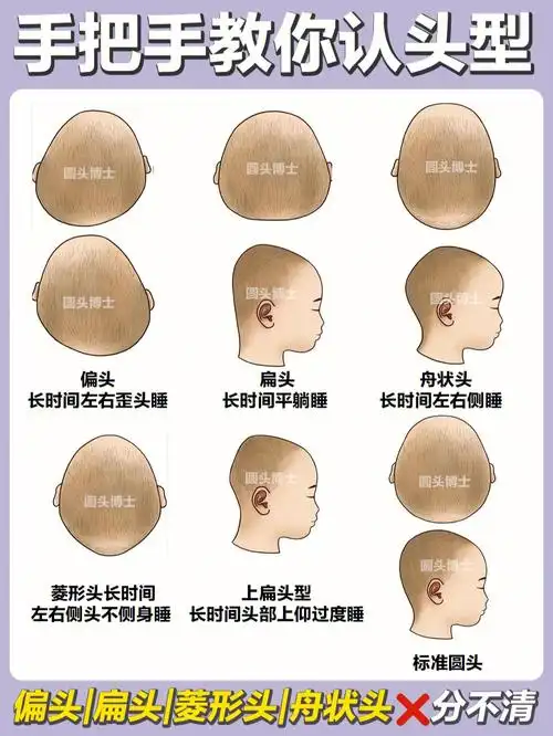 一边圆润好看,一边扁平垂直986995扁头①头窄后宽 ,头型前面