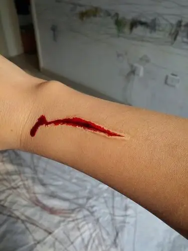 枪伤 刀伤 擦伤