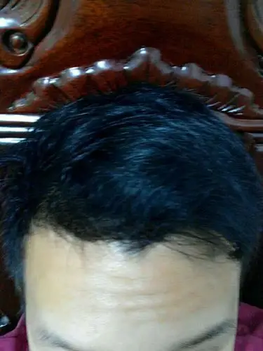 头发发质干枯毛躁卷发 头盖中间凹陷很大 头顶前后比较高 因为头顶