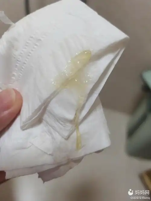 今天39周 5了,下午上厕所出来一坨像胶一样的分泌_妈妈网孕育社区