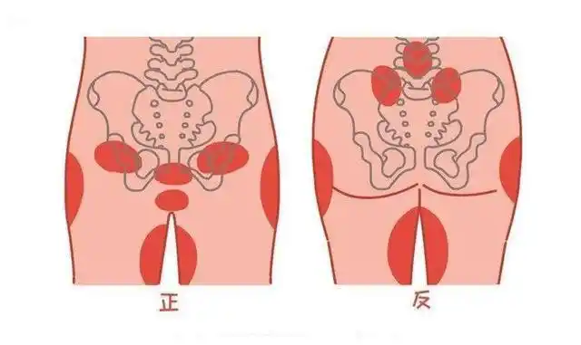 "耻骨痛"到底是哪里痛?孕期有四类孕妇容易被它"缠身"