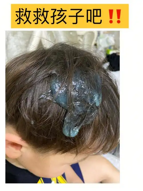 救救孩子吧谁发明的起泡胶出来挨打