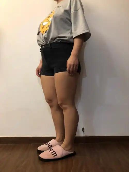 我的腿型很丑,有点萝卜腿的感觉,整个腿也很弯.