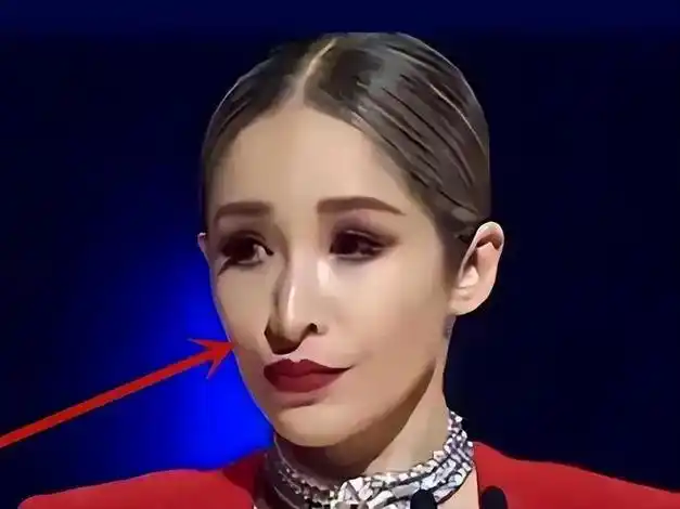 萧亚轩变形计:从潇洒小姐到满脸"科技与狠活",那么美为何整容