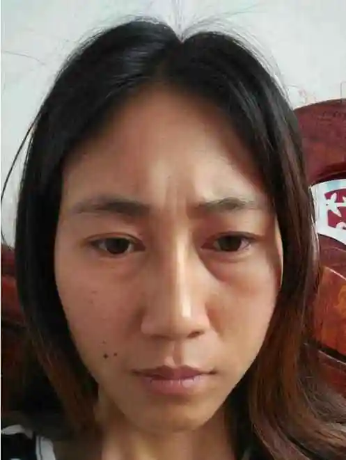 皮肤又黄又黑该怎么办?