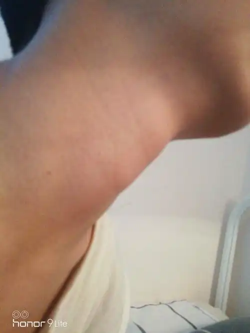 男生喉结长成这样正常吗