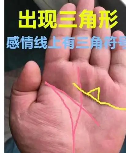 大拇指有此纹不论男女一辈子偏财运极佳买啥啥就中大奖