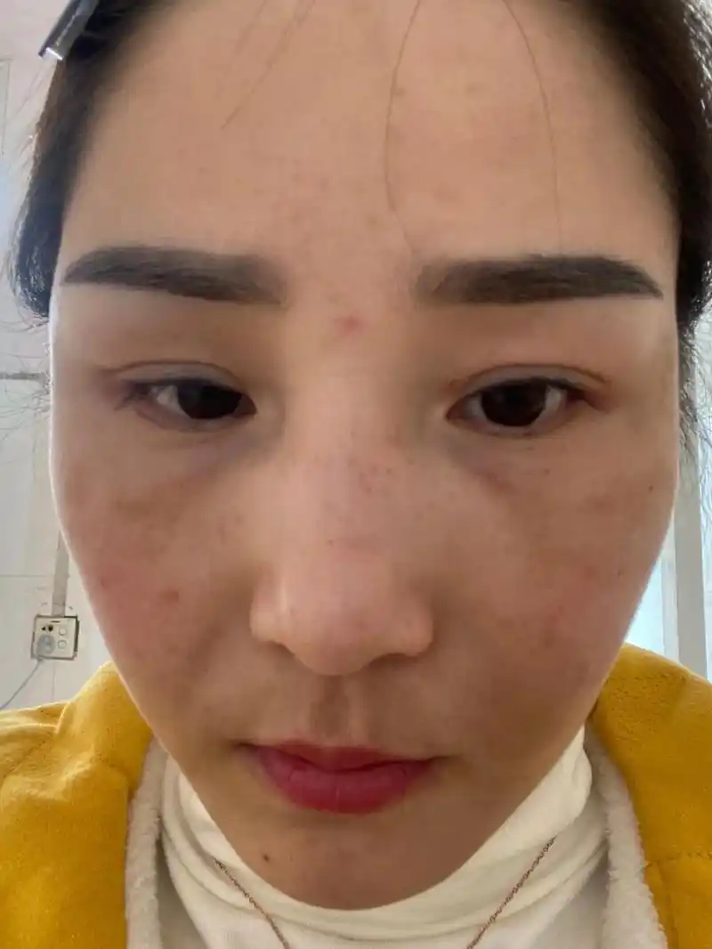 👍祛斑斑,祛黄,肤色不均 的直接找我