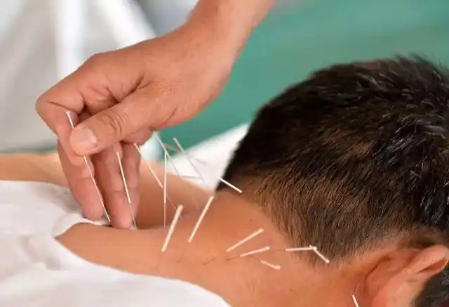 针灸有什么作用针灸可以随便扎吗这几个注意事项一定要知道