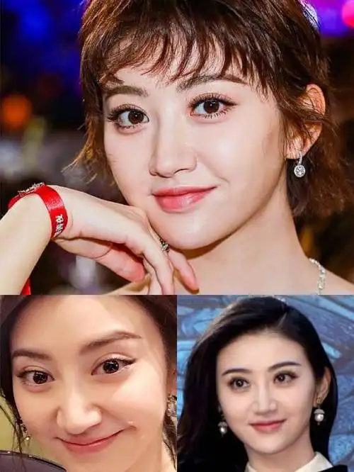 景甜亲身演绎:这年头割双眼皮得慎重,一个失败就是悲伤蛙了