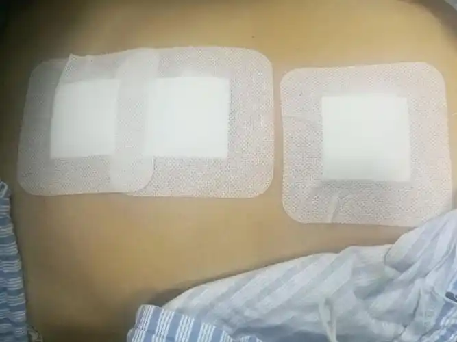 性阑尾炎合并腹膜炎者;(4)不能完全排除腹部外科疾病及女性内生殖系统