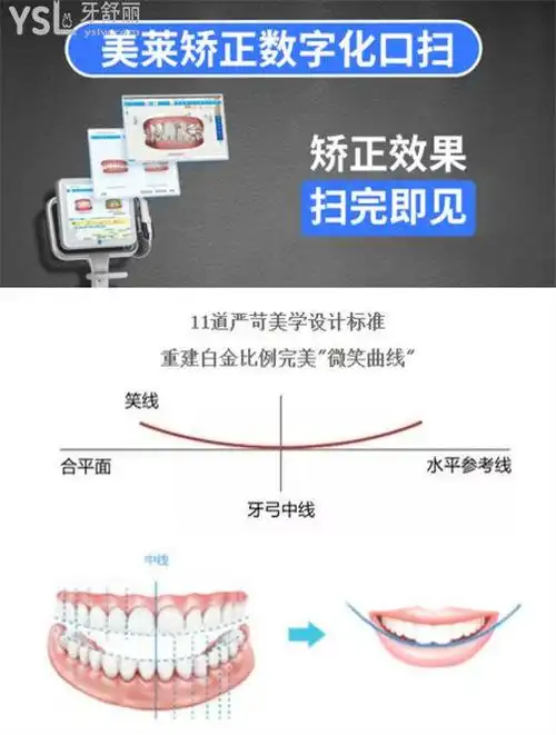 长沙美莱口腔科整牙怎么样是正规靠谱的吗8000的牙套能做吗