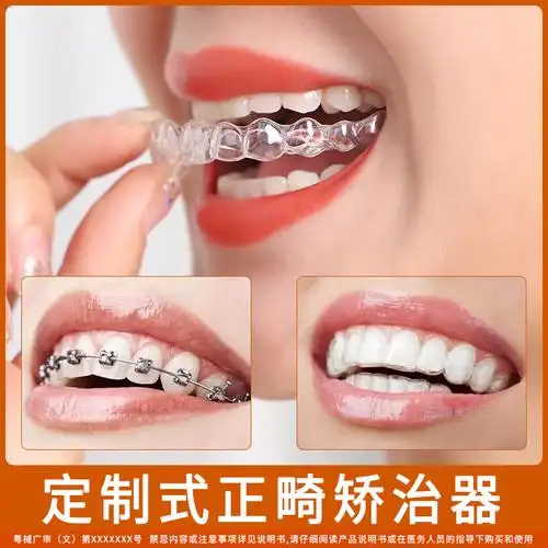 牙套隐形矫正器5d透明龅牙门牙缝隙大整形牙套整牙纠正牙齿保持器