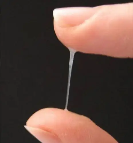 粘液透明白带04它也可能是慢性炎症,如慢性输卵管炎,子宫肌瘤感染等.