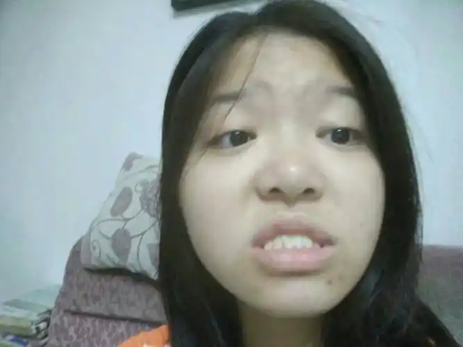 我今年十五岁我的牙齿是很严重的地包天我去过医院想做矫正但医生都说