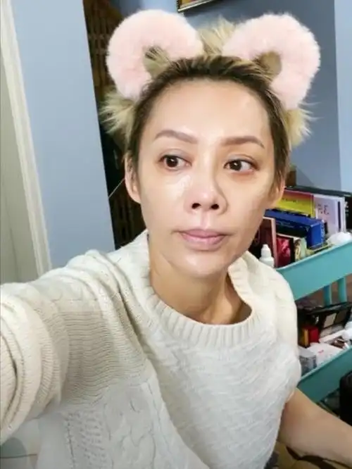 48岁宁静素颜显老态眼球突出太瘆人开完美颜也遮不住皮肤松弛