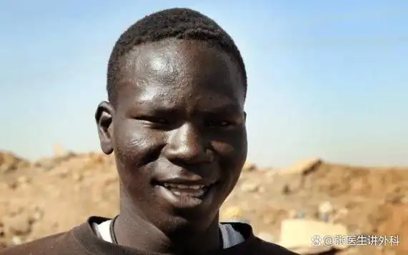 黑人在中国泛滥为何黑二代统一的黑皮肤卷头发医生这样说