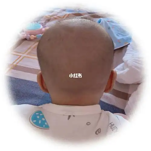 宝宝头型还需要怎么调