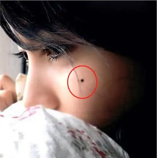 什么是善痣?什么是恶痣?