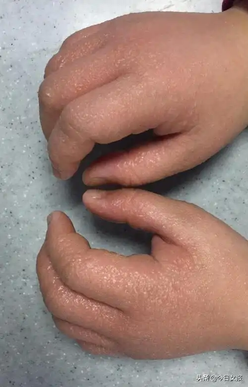 起泡胶太黏了怎么办,自己做的起泡胶太黏了怎么办