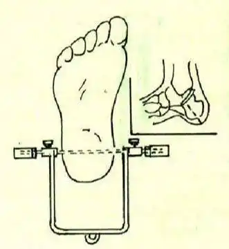 图解骨科牵引的常用方式及技巧