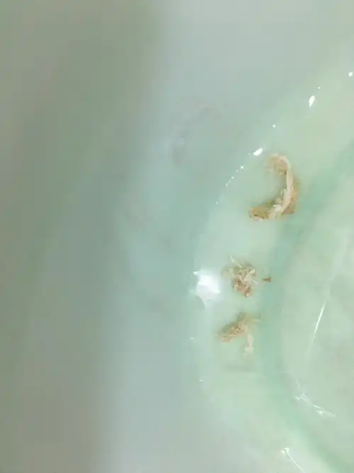 2018-03-26   展开全部 糜烂 这是用了粉嫩私户凝胶以后排出来的垃