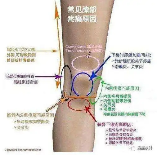 膝盖内侧疼痛