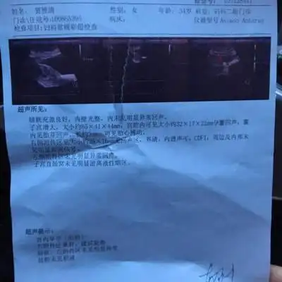 怀孕37天孕囊正常是多大?