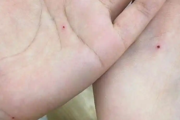 朱砂痣的象征和寓意,有趣的说法?