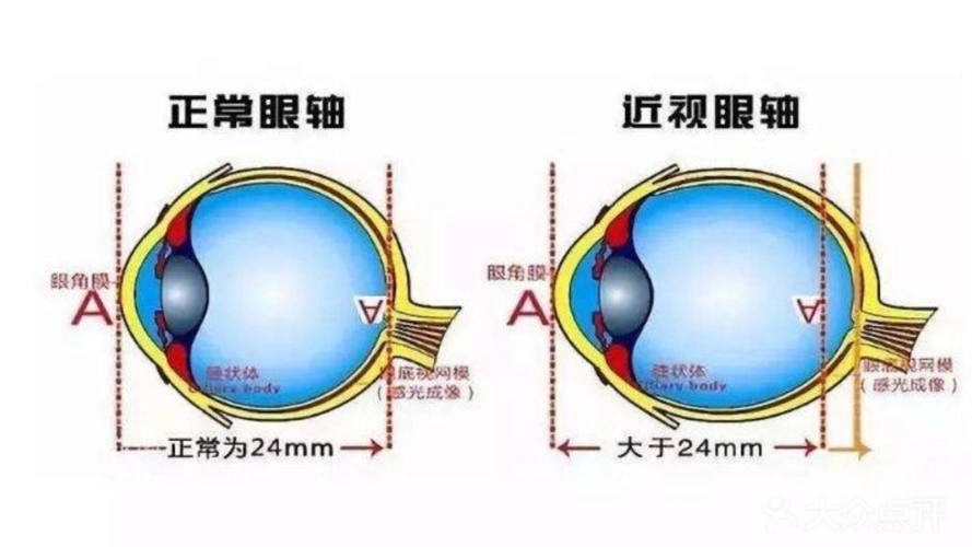 【精卓眼镜团购】-大众点评网团购成都站