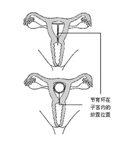 你不喜欢套她也不喜欢这些环