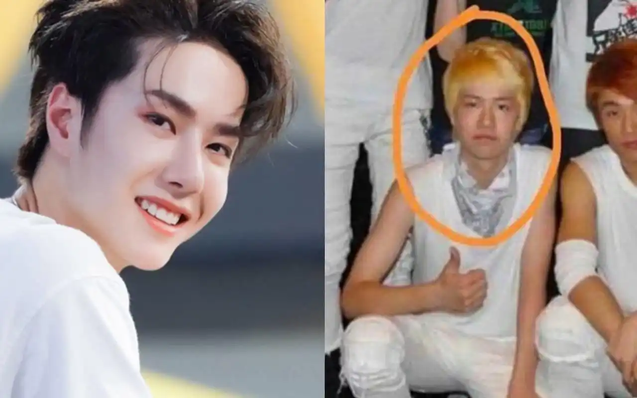 王一博再陷整容风波,14岁旧照惊现凸嘴短下巴,堪称换头