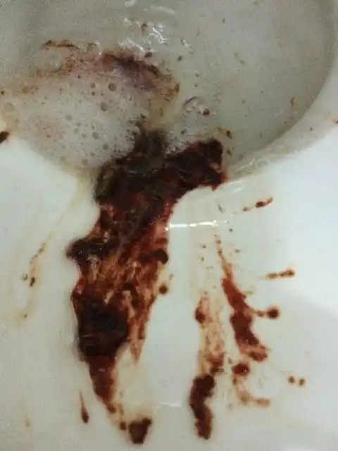 怀孕75天左右吐血怎么处理呢?谁帮帮忙