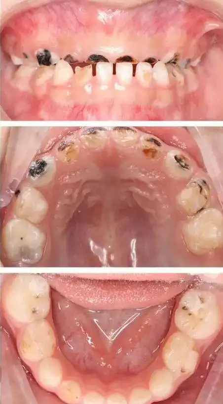 儿牙300问第十二期用案例来学习助你成为更强口腔医师