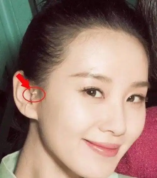 [太阳]耳旁附耳被称为"拴马桩"为富贵之相;如若面相中有官相,那么将来