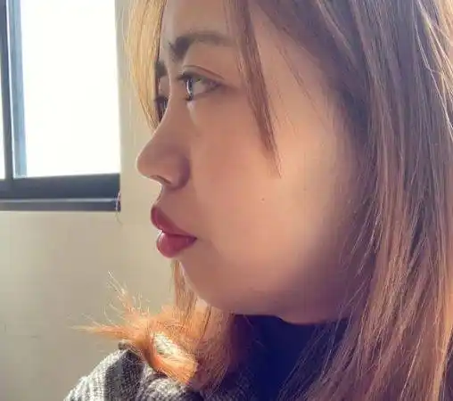 公认最丑的几大"唇形",一张嘴毁掉整个脸,看看你的是不是?