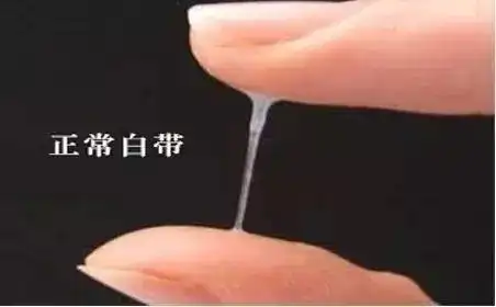 女生内裤总被染成黄色还有瘙痒该怎么办