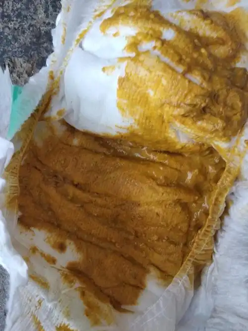 脂肪泻是什么样子的