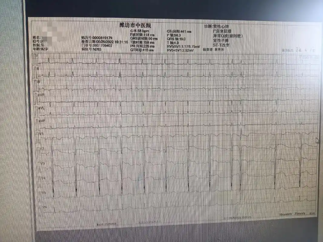 各种心电图的表现.窦性心律:p波在i,ii,avf导联及v3 - 抖音
