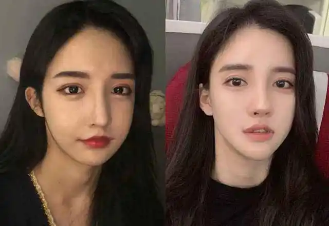 整容脸有哪些特征?潘南奎这次踩中太多雷区|卧蚕|网红|杨颖_网易订阅