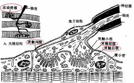 运动终板模式图