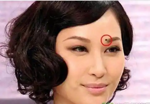 面部痣的位置与命运,看看你有没有富贵痣
