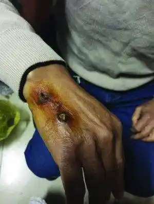 咬人形成常态的狗子如何处理为妥