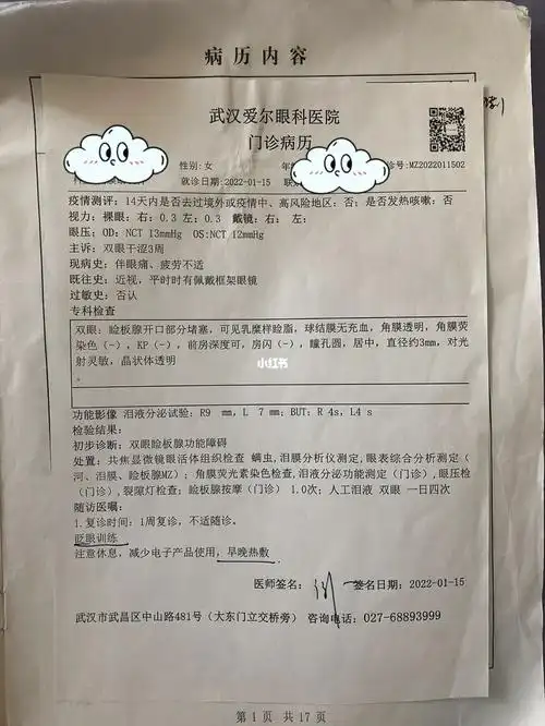 我知道了有个名词叫做"干眼症"
